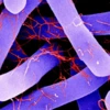 False-color image of C. difficile vegetative cell and Ruthenium Red-stained flagella.